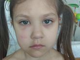 Дочку посукали или комары