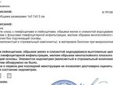 Результат пайпель биопсии эндометрия