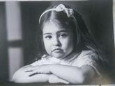 Мира. Недоношенный ребенок. 2года 7 месяцев. Резус-конфликт.Гбн.Гбп.