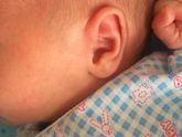 Что это за краснота? И прыщечки если приглядеться