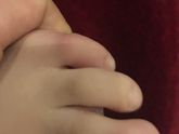 Девочки спасайте что это