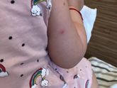 Девочки , может сталкивался