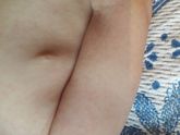 Подскажите симптомы краснухи.
