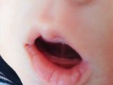 Зубы