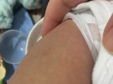 Потничка или продолжение аллерги ? Я скоро сойду с ума 😭😭😭