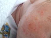 Соль с чередой