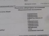 Пришли анализы