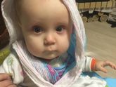Девочки у меня что косой ребёнок?