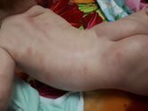 Кажется нашла аллерген