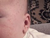 Девочки как проходит цветение?