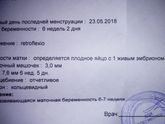 моё первое УЗИ.