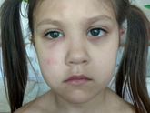Дочку посукали или комары