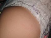 Атопический?