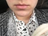 Высыпь не знаю из за чего,может гормоны?