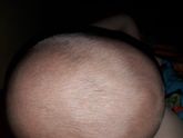 большой родничок в год и 8 мес