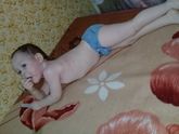 Ветрянка???