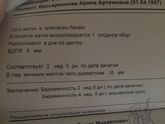 5 недель 3 дня