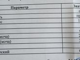 Помогите расшифровать общий анализ мочи