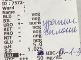 Анализ мочи