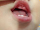 Зубы
