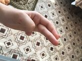 Ребёнок переодически вот так