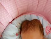 кефалогематома