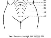 Расположение плода, домашний допплер