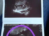 3 триместр 🤰
