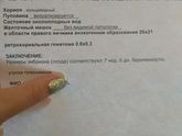 Сижу реву, девочки кто