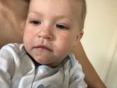 Аллергия?