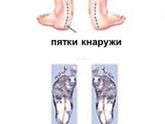 Ортопед