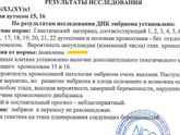 ПГД - результаты