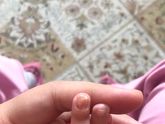 Ногти