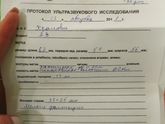 Узи