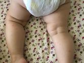 Аллергия или нет?