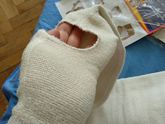 Компрессионные чулки