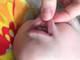 Дочь упала и порвала уздечку! Что делать ?
