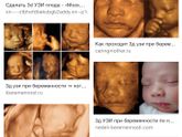 Девочки это какое УЗИ?
