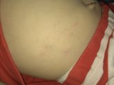 Привет) Подскажите, от чего