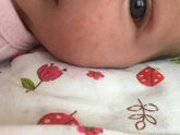 Цветение или аллергия
