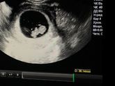 Фотографии на 2 месяце беременности