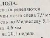2ой скрининг