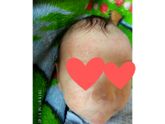 Девочки, это аллергия или