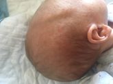 Цветение или аллергия/Это было цветение,прошло!Просто промывала личико водичкой.