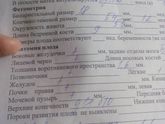 Первый скрининг