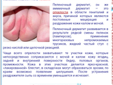 Пеленочный дерматит сос сос сос чем вылечить!