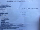 УЗИ малого таза с доплером!