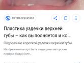 Так и останется щель