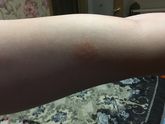 Такая фигня у взрослого