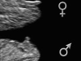 Пол по фото узи